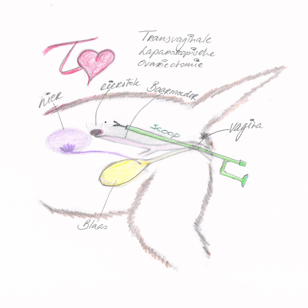 Tekening Lap OVE Transvaginaal